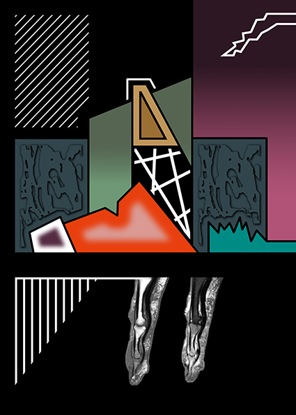 260113-1gr